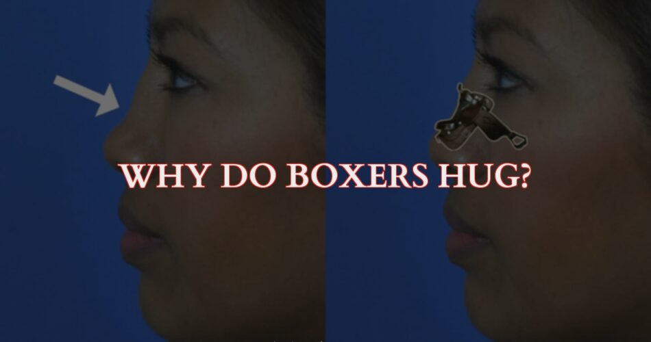 Why Do Boxers Hug?